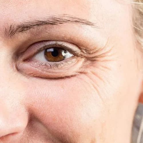 Nahaufnahme der Augenpartie – Anti-Aging-Behandlung gegen feine Linien