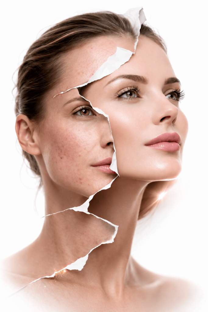 hautprobleme behandlung küssnacht medical beauty