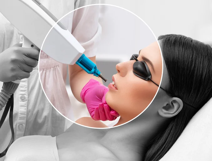 Removal of permanent makeup on the lips of a woman.Carbon face peeling in a beauty salon. Hardware cosmetology treatment.