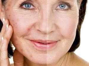 medical beauty behandlungen schweiz hautanalyse lw medical beauty